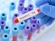 Mitos e verdades sobre as silenciosas hepatites virais