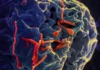 Ebola no Brasil – São Paulo investiga caso suspeito e mantém paciente de 37 anos isolado