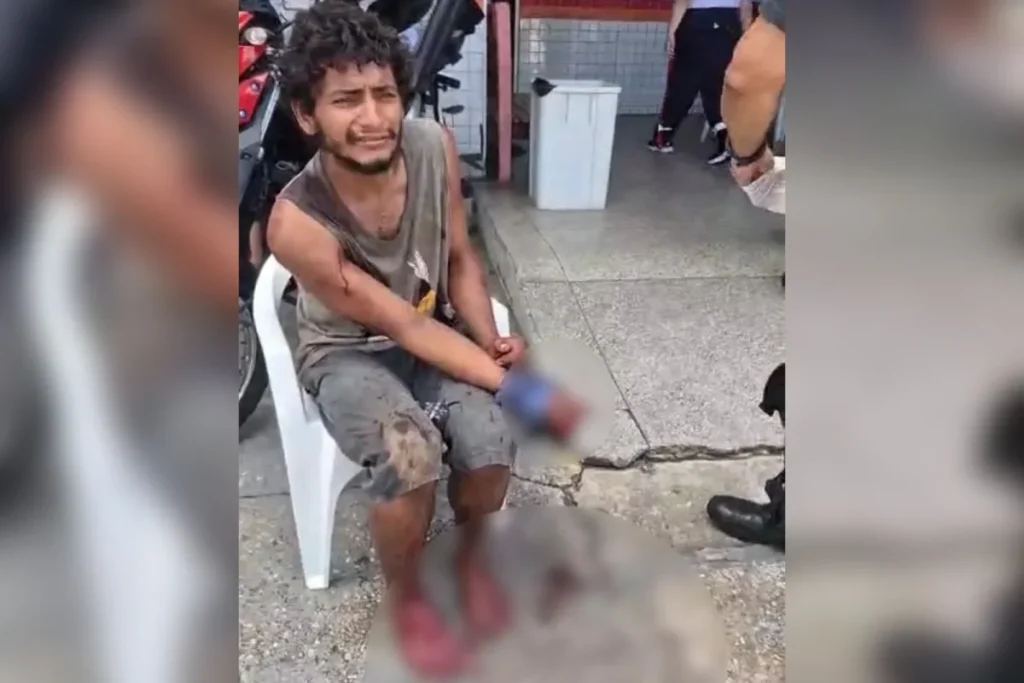 Dependente químico tem dedos amputados em suposta tentativa de assalto – vídeo