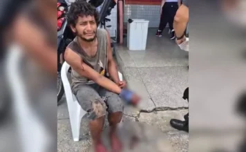 Dependente químico tem dedos amputados em suposta tentativa de assalto – vídeo