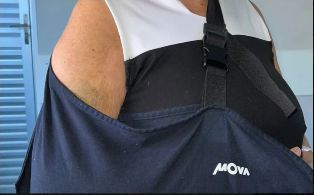 Merendeira idosa cai, quebra braço e está há 1 mês ouvindo desculpas para não ser operada, no regional de Vilhena