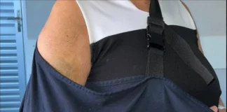 Merendeira idosa cai, quebra braço e está há 1 mês ouvindo desculpas para não ser operada, no regional de Vilhena