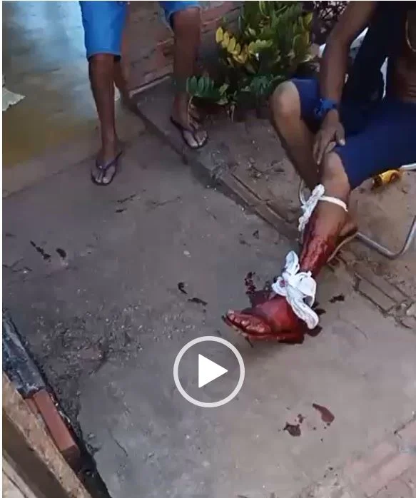 É bala pra todo lado - Dois em moto atiram 18 vezes contra morador de Chupinguaia, mas só um acertou